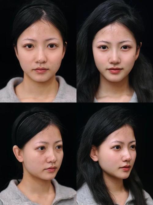 AI整容前后对比照热传 日本掀自我和解新浪潮